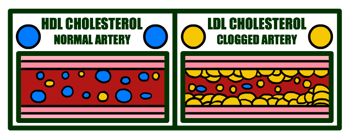 Normal Artery vs Clogged Artery